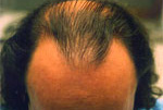 Male Hair example 3 before